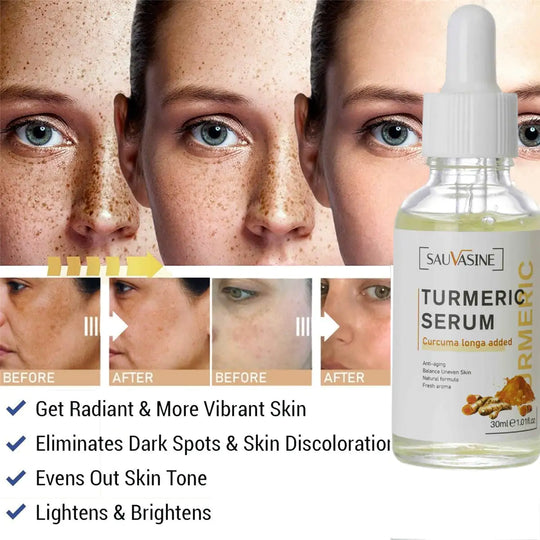 Turmeric Face Whitening Serum - Beauty4You